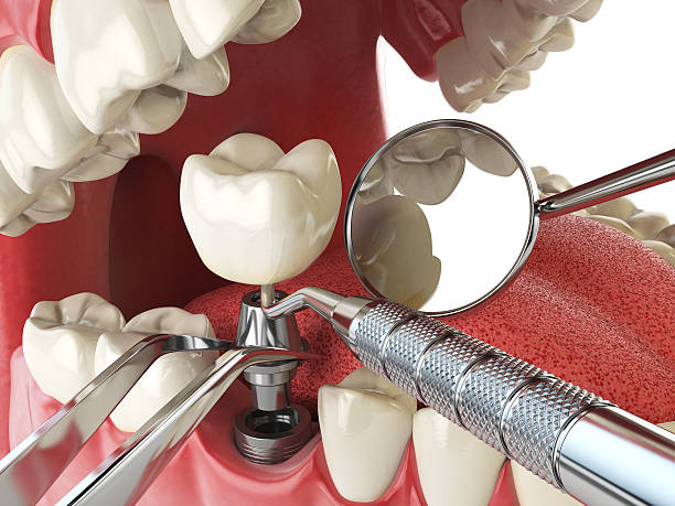 Best Emergency Dental Care for Trauma or Injury in Chamblee, GA