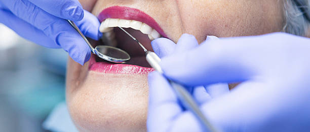 Best Emergency Tooth Extraction in Chamblee, GA